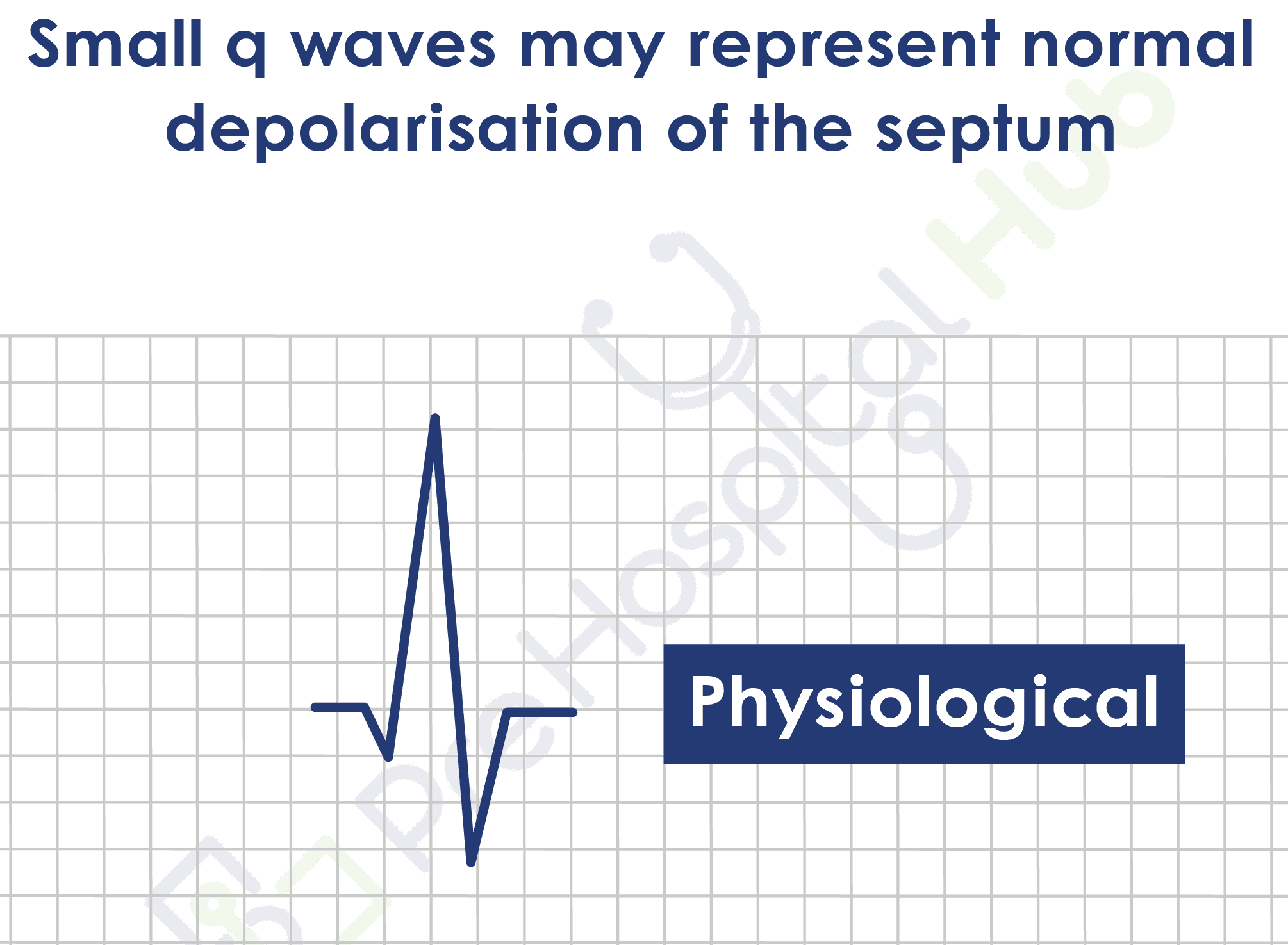 Normal Q Wave