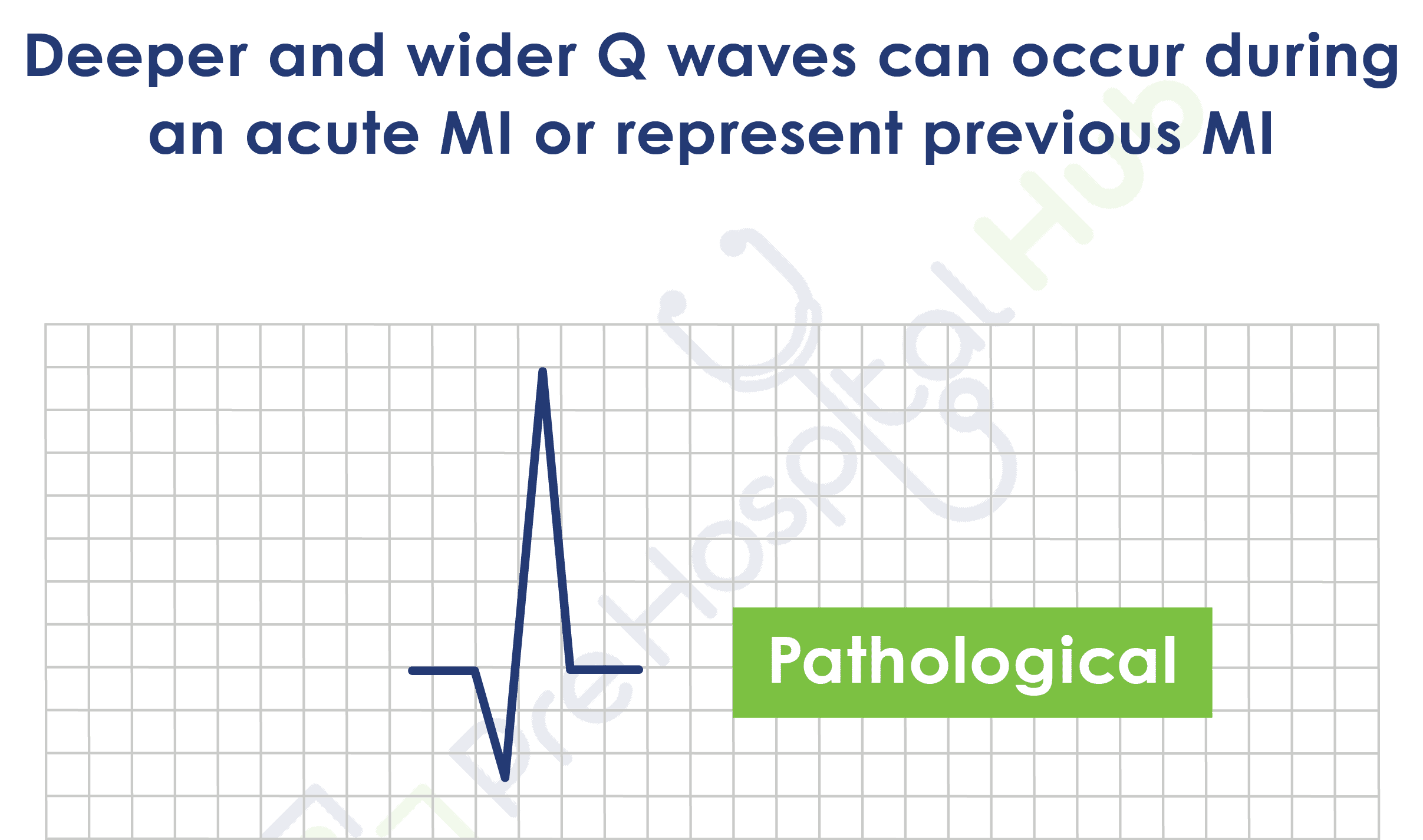 Pathological Q Waves Pathological Q Waves